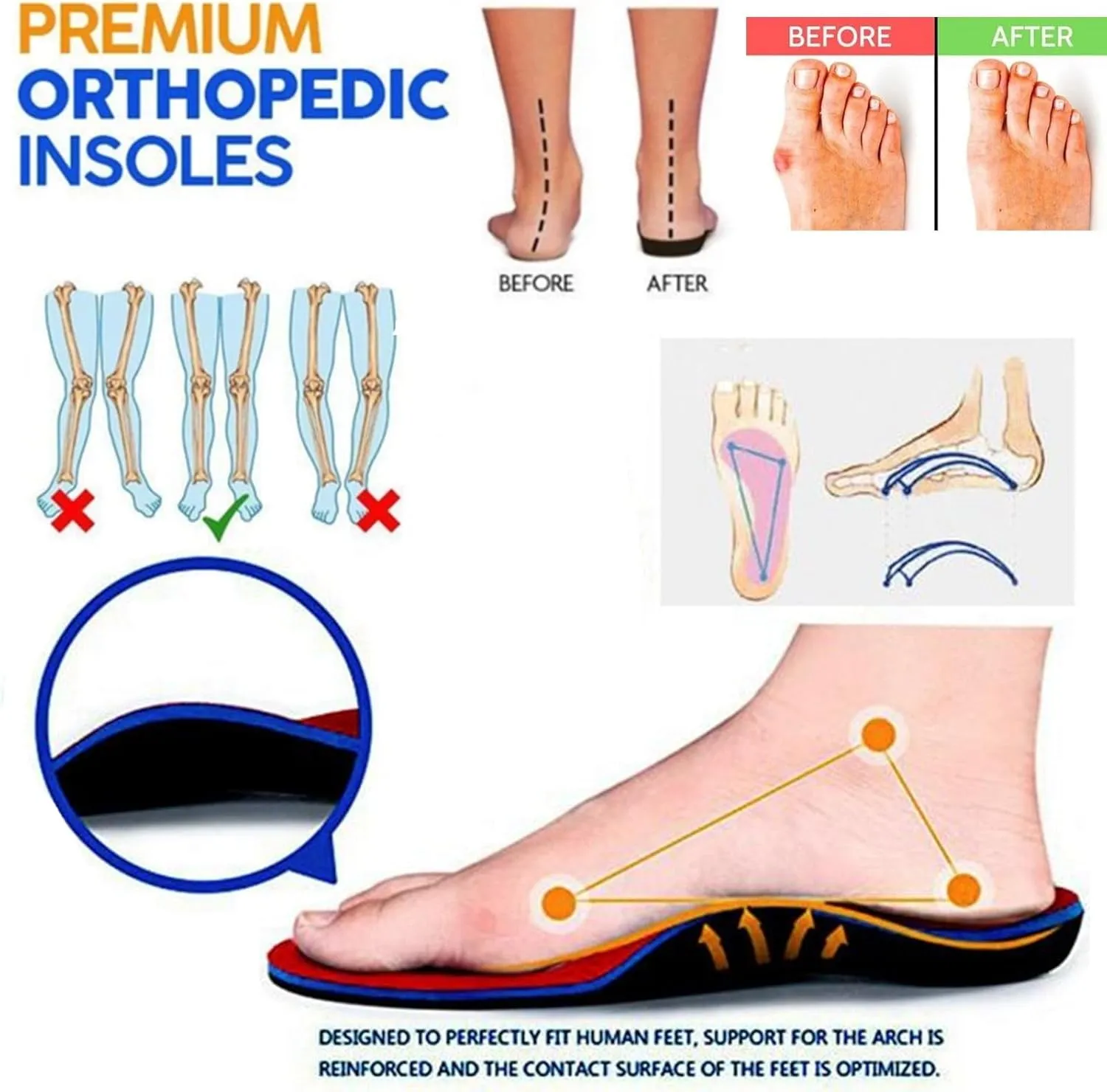 Mules for Women Breathable Hollow Out Closed Toe Slip On Slippers Casual Orthopedic Diabetic Walking Shoes with Arch Support Summer Backless Sandals Comfort Outdoor Beach Slippers